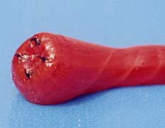 gusano americano o de sangre